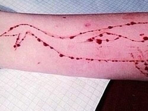 Blue Whale, 20enne indagata: "Obbligava una 12enne a ferirsi"