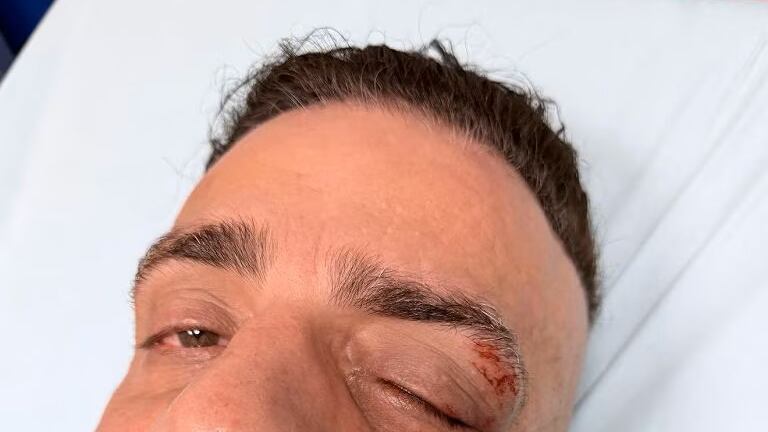 Aggredito il "Cicalone": lo youtuber vittima dei borseggiatori in metro a Roma