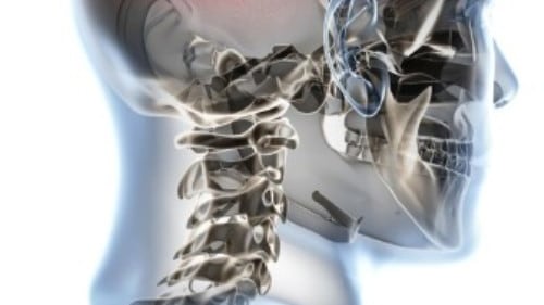 La scoperta dei medici di Torino rivoluziona la lotta al mal di testa