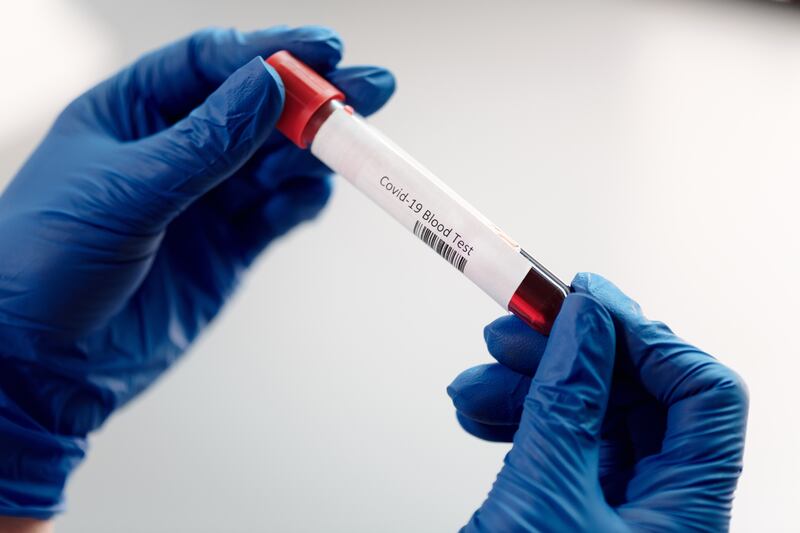 Analisi del sangue