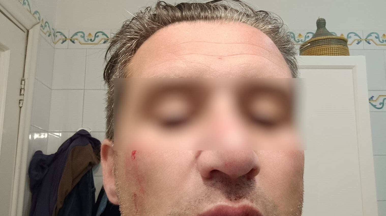 Pugni in faccia perché va troppo piano in moto