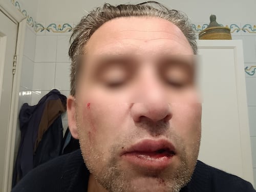 Pugni in faccia perché va troppo piano in moto