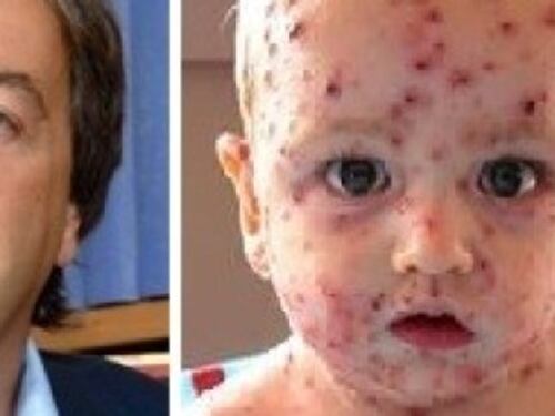 Il professore: "Non vaccinate i vostri figli? Ecco cosa gli succede"