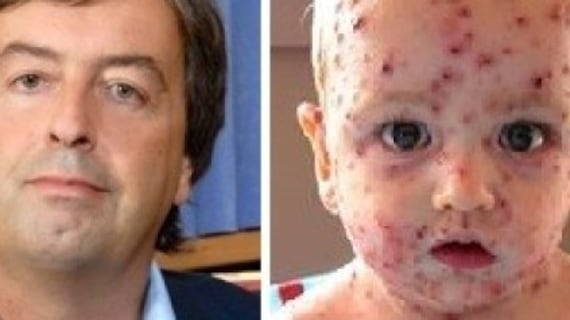Il professore: "Non vaccinate i vostri figli? Ecco cosa gli succede"