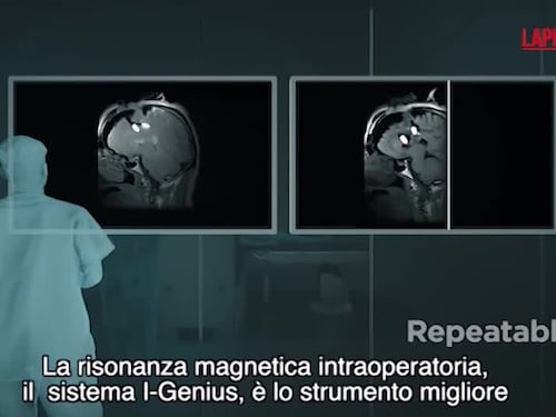 Esaote: entra nel campo della neurochirurgia e presenta il sistema di risonanza magnetica intraoperatoria I-Genius