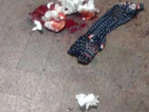 Aggressione horror in Porta Garibaldi: turista accoltellato al volto