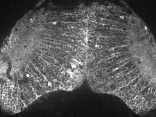 Come si "accende" il cervello del pesce quando vede la preda