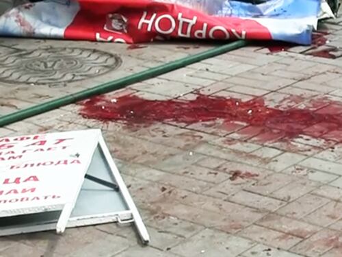 Così si muore in Ucraina