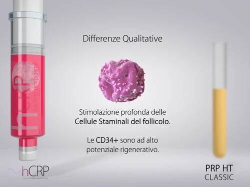 Differenze tra PRP capelli e Protocollo bSBS