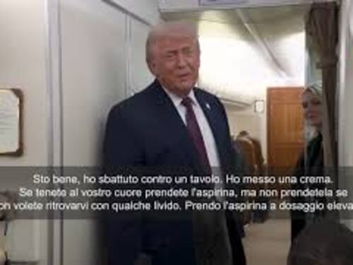 Trump spiega livido sulla sua mano: L'ho sbattuta contro un tavolo. Ematoma colpa dell'aspirina SOTT